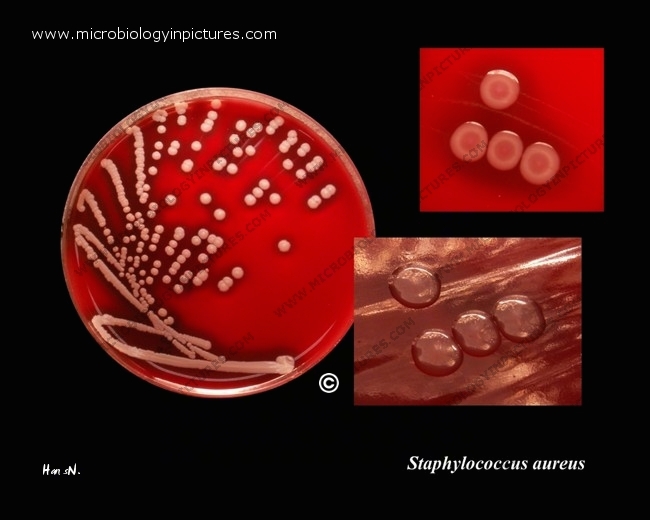 s.aureus streaked on blood agar